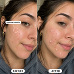 Alvea + Clear Invisible Patch